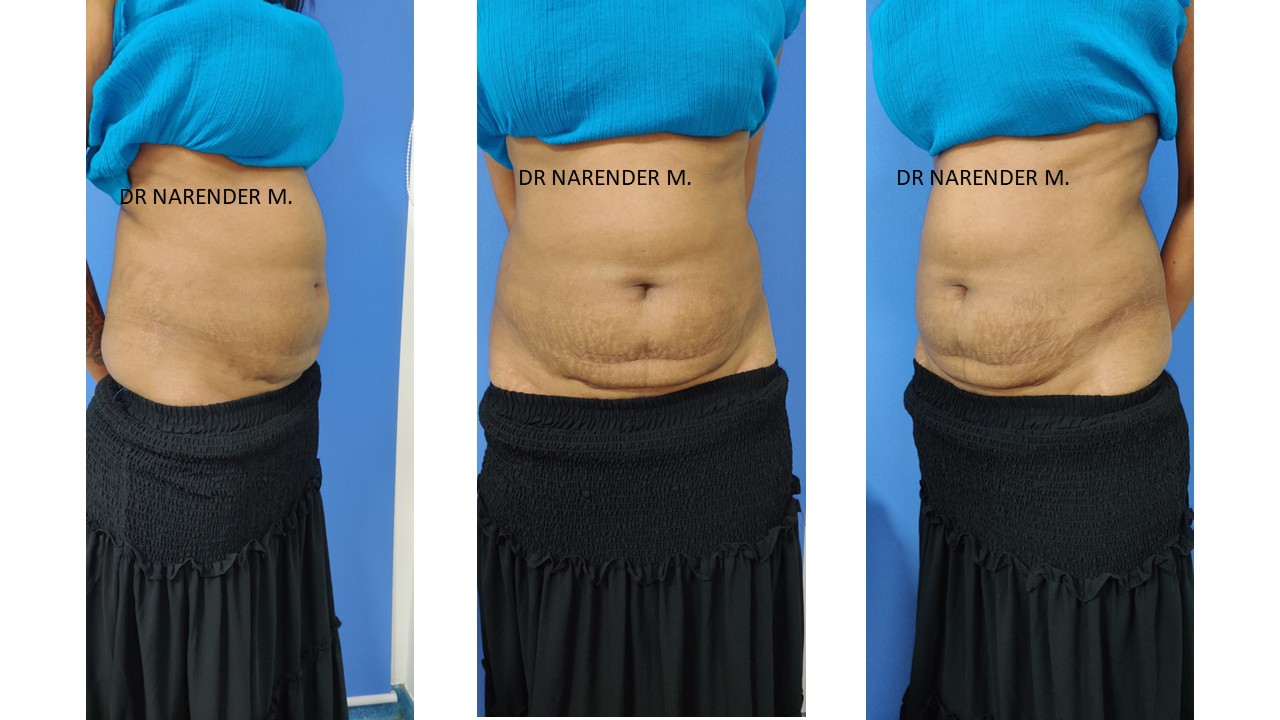 Suvarna Talk Photo 2